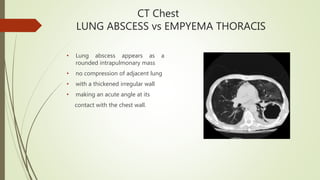 CT Chest
LUNG ABSCESS vs EMPYEMA THORACIS
• Lung abscess appears as a
rounded intrapulmonary mass
• no compression of adjacent lung
• with a thickened irregular wall
• making an acute angle at its
contact with the chest wall.
 
