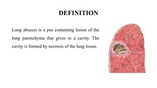 DEFINITION
Lung abscess is a pus containing lesion of the
lung parenchyma that gives to a cavity. The
cavity is formed by necrosis of the lung tissue.
 