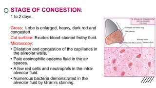 STAGE OF CONGESTION:
1 to 2 days.
Gross: Lobe is enlarged, heavy, dark red and
congested.
Cut surface: Exudes blood-stained frothy fluid.
Microscopy:
• Dilatation and congestion of the capillaries in
the alveolar walls.
• Pale eosinophilic oedema fluid in the air
spaces.
• A few red cells and neutrophils in the intra-
alveolar fluid.
• Numerous bacteria demonstrated in the
alveolar fluid by Gram’s staining.
 