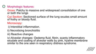 Morphologic features:
Gross: Patchy to massive and widespread consolidation of one
or both the lungs
Cut Section: Sectioned surface of the lung exudes small amount
of frothy or bloody fluid.
Microscopy:
i) Interstitial inflammation.
ii) Necrotising bronchiolitis
iii) Reactive changes
iv) Alveolar changes: Oedema fluid, fibrin, scanty inflammatory
exudate and coating of alveolar walls by pink, hyaline membrane
similar to the one seen in respiratory distress syndrome.
 