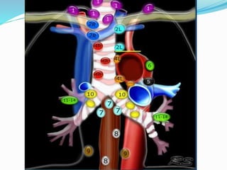 Lymph nodal stations in ca lung