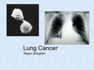Lung Cancer Megan Slaughter 