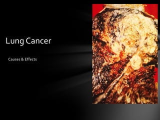 Lung Cancer
Causes & Effects
 