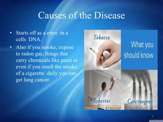 Causes of the Disease
• Starts off as a error in a
cells DNA.
• Also if you smoke, expose
to radon gas, things that
carry chemicals like paint or
even if you smell the smoke
of a cigarette daily you can
get lung cancer.

3

 