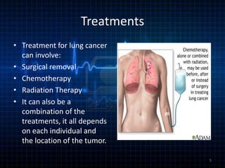 Treatments
• Treatment for lung cancer
can involve:
• Surgical removal
• Chemotherapy
• Radiation Therapy
• It can also be a
combination of the
treatments, it all depends
on each individual and
the location of the tumor.
5

 