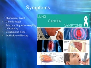Symptoms
• Shortness of breath
• Chronic cough
• Pain or aching when coughing
or breathing
• Coughing up blood
• Difficulty swallowing

7

 