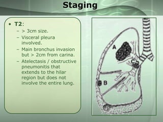 Staging
• T2:
– > 3cm size.
– Visceral pleura
involved.
– Main bronchus invasion
but > 2cm from carina.
– Atelectasis / obstructive
pneumonitis that
extends to the hilar
region but does not
involve the entire lung.

 