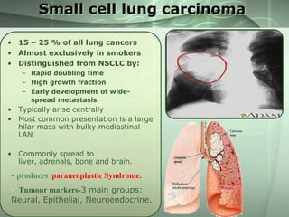Small cell lung carcinoma
• 15 – 25 % of all lung cancers
• Almost exclusively in smokers
• Distinguished from NSCLC by:
– Rapid doubling time
– High growth fraction
– Early development of widespread metastasis

• Typically arise centrally
• Most common presentation is a large
hilar mass with bulky mediastinal
LAN
• Commonly spread to
liver, adrenals, bone and brain.

• produces paraneoplastic Syndrome.
• Tumour markers-3 main groups:
Neural, Epithelial, Neuroendocrine.

 