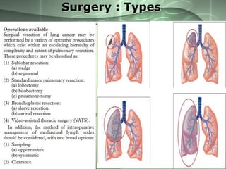 Surgery : Types
• Radical operation:

– Pneumonectomy.

• Lung Conservation:
–
–
–
–

Lobectomy.
Sleeve resection.
Wedge resection.
Segmentectomy.

• Mediastinal lymph node
dissection:

– Provides complete nodal
staging.
– Identifies patients who require
adjuvant radiotherapy.
– Improves survival.
– Improves local control.

 