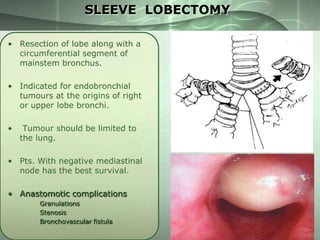 SLEEVE LOBECTOMY
• Resection of lobe along with a
circumferential segment of
mainstem bronchus.
• Indicated for endobronchial
tumours at the origins of right
or upper lobe bronchi.
•

Tumour should be limited to
the lung.

• Pts. With negative mediastinal
node has the best survival.
• Anastomotic complications
Granulations
Stenosis
Bronchovascular fistula

 