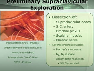 Preliminary Supraclavicular
Exploration
• Dissection of:
–
–
–
–
–
Posterolateral (Shaw - Paulson)
Anterior cervicothoracic (Dartevelle)

Hemi-clamshell (Burt)
Anteroposterior “hook” (Niwa)
VATS - Posterior

Supraclavicular nodes
S.C. artery
Brachial plexus
Scalene muscles
Phrenic nerve

• Adverse prognostic factors:

– Horner’s syndrome
– N2, N3 disease

– Incomplete resection
• 9% 5yr survival

 