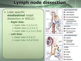 Lymph node dissection
• Lobe specific
mediastinal nodal
dissection in NSCLC:
– Right Side:
• Upper lobe (1,2,3,4,7)
• Middle lobe (1,2,3,4,7)
• Lower lobe (1,2,3,4,7,8,9)

– Left Side:
• Upper lobe (4,5,6,7)
• Lower lobe (4,5,67,8,9)

 