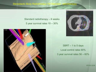 Stereotactic Body Radiotherapy VS Standard radiotheraypy

Standard radiotherapy – 6 weeks
5 year survival rates 10 – 30%

SBRT – 1 to 5 days

Local control rates 90%
3 year survival rates 56 – 60%

RTOG 0236

 