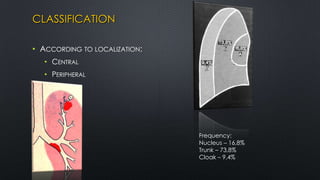CLASSIFICATION
• ACCORDING TO LOCALIZATION:
• CENTRAL
• PERIPHERAL
Frequency:
Nucleus – 16,8%
Trunk – 73,8%
Cloak – 9,4%
 