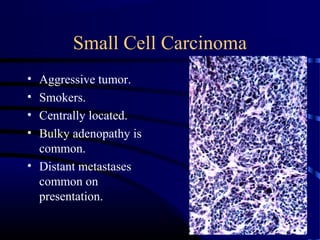 Small Cell Carcinoma
• Aggressive tumor.
• Smokers.
• Centrally located.
• Bulky adenopathy is
common.
• Distant metastases
common on
presentation.
 