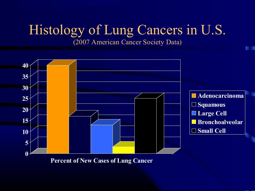 Staging Of Lung Cancer Chart