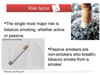 Lung cancer | PPT