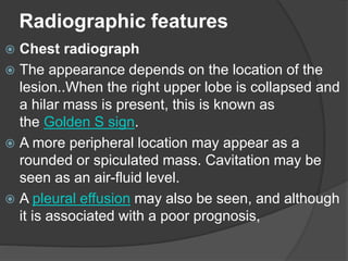 Lung cancer radiology | PPTX