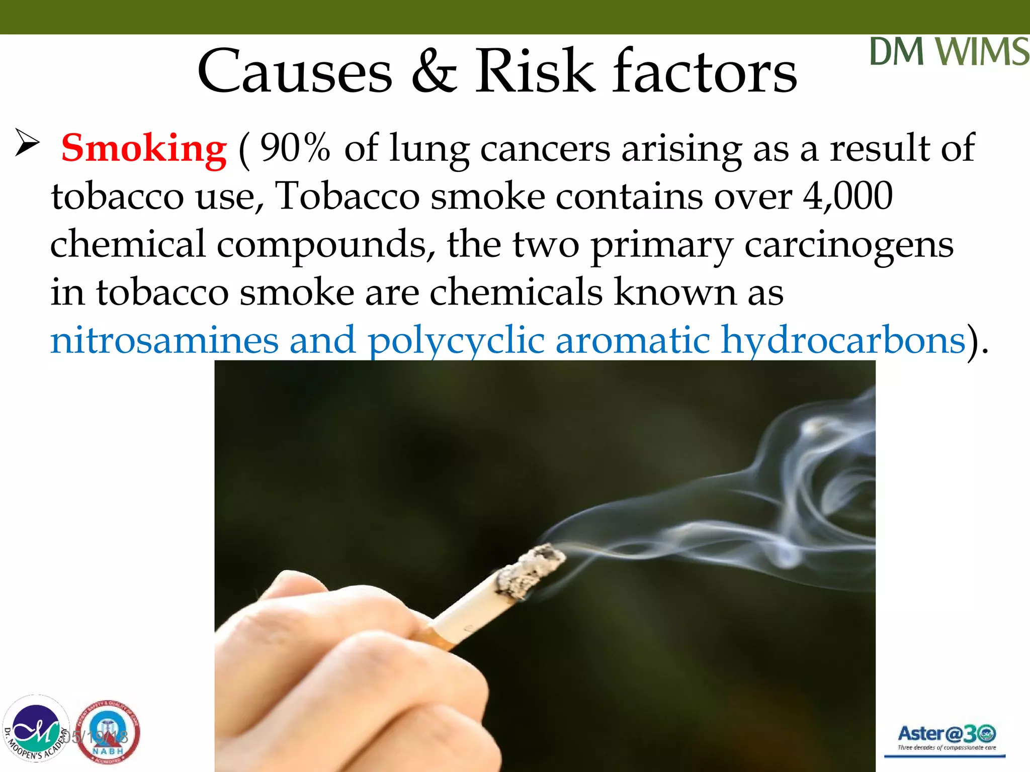 Lung cancer | PPT