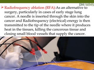05/19/18 29
 Radiofrequency ablation (RFA):As an alternative to
surgery, particularly in cases of early stage lung
cancer. A needle is inserted through the skin into the
cancer and Radiofrequency (electrical) energy is then
transmitted to the tip of the needle where it produces
heat in the tissues, killing the cancerous tissue and
closing small blood vessels that supply the cancer.
05/19/18
 