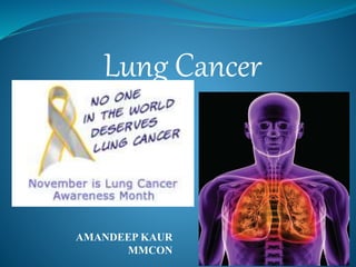 AMANDEEP KAUR
MMCON
Lung Cancer
 