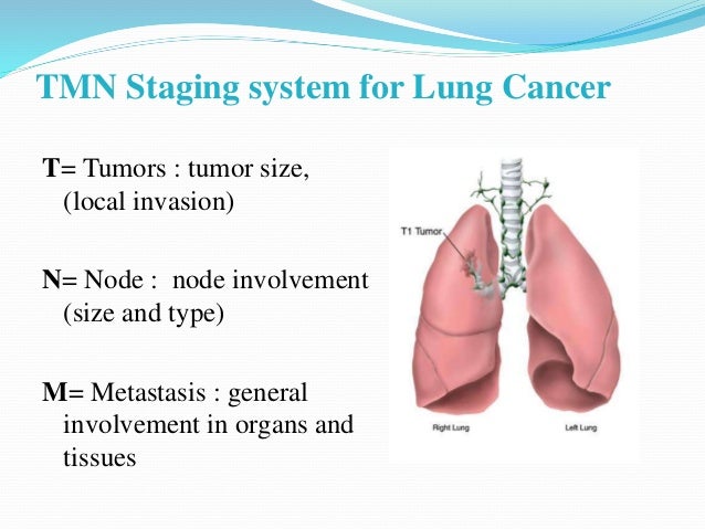 Lung Cancer
