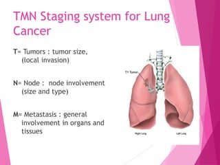 Tmn System Lung cancer by Dr. Aabidullah Rahimee | PPT