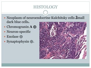 HISTOLOGY
 Neoplasm of neuroendocrine Kulchitsky cells Žsmall
dark blue cells.
 Chromogranin A ⊕
 Neuron-specific
 Enolase ⊕
 Synaptophysin ⊕.
 