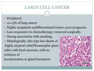 LARGE CELL CANCER
 Peripheral
 10-15% of lung cancer
 Highly anaplastic undifferentiated tumor; poor prognosis.
 Less responsive to chemotherapy; removed surgically.
 Strong association with smoking.
 Histologically, this type has sheets of
highly atypical cells(Pleomorphic giant
cells) with focal necrosis, with no
evidence of
keratinization or gland formation.
 
