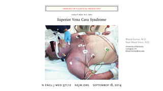Superior Vena Cava Syndrome
Etiologic Factors:
Overall
Thrombosis And Non-Malignant Causes
Increased use of catheters and ...
