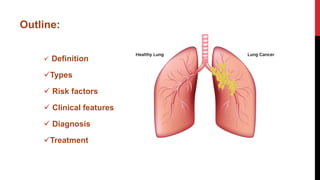 Outline:
 Definition
Types
 Risk factors
 Clinical features
 Diagnosis
Treatment
 
