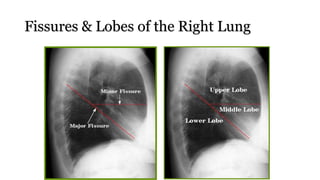 Fissures & Lobes of the Right Lung
 