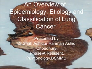 An Overview of
Epidemiology, Etiology and
Classification of Lung
Cancer
Presented by
Dr.Shah Ashiqur Rahman Ashiq
Choudhury
Phase-A Resident,
Pulmonology,BSMMU
 