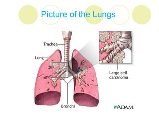 Picture of the Lungs
 