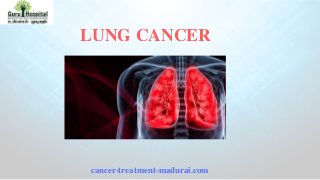 LUNG CANCER
cancer-treatment-madurai.com
 