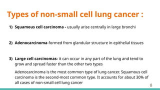 Types of non-small cell lung cancer :
1) Squamous cell carcinoma - usually arise centrally in large bronchi
2) Adenocarcinoma-formed from glandular structure in epithelial tissues
3) Large cell carcinomas- it can occur in any part of the lung and tend to
grow and spread faster than the other two types
Adenocarcinoma is the most common type of lung cancer. Squamous cell
carcinoma is the second-most common type. It accounts for about 30% of
all cases of non-small cell lung cancer
8
 