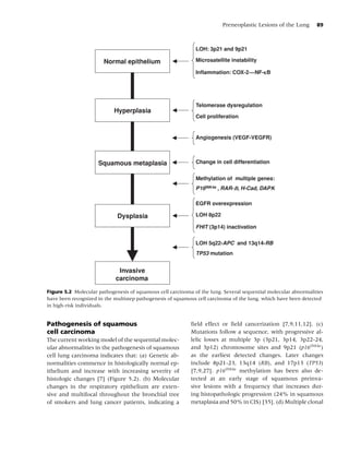 Preneoplastic Lesions of the Lung       89



                                                              LOH: 3p21 and 9p21

                       Normal epithelium                      Microsatellite instability




                                                              Telomerase dysregulation
                            Hyperplasia
                                                              Cell proliferation


                                                              Angiogenesis (VEGF-VEGFR)



                     Squamous metaplasia                      Change in cell differentiation


                                                              Methylation of multiple genes:
                                                              P16INK4a , RAR- , H-Cad, DAPK

                                                              EGFR overexpression

                             Dysplasia                        LOH 8p22

                                                              FHIT (3p14) inactivation


                                                              LOH 5q22-APC and 13q14-RB
                                                              TP53 mutation


                             Invasive
                            carcinoma
Figure 5.2 Molecular pathogenesis of squamous cell carcinoma of the lung. Several sequential molecular abnormalities
have been recognized in the multistep pathogenesis of squamous cell carcinoma of the lung, which have been detected
in high-risk individuals.


Pathogenesis of squamous                                    ﬁeld effect or ﬁeld cancerization [7,9,11,12]. (c)
cell carcinoma                                              Mutations follow a sequence, with progressive al-
The current working model of the sequential molec-          lelic losses at multiple 3p (3p21, 3p14, 3p22-24,
ular abnormalities in the pathogenesis of squamous          and 3p12) chromosome sites and 9p21 (p16INK4a )
cell lung carcinoma indicates that: (a) Genetic ab-         as the earliest detected changes. Later changes
normalities commence in histologically normal ep-           include 8p21-23, 13q14 (RB), and 17p13 (TP53)
ithelium and increase with increasing severity of           [7,9,27]. p16INK4a methylation has been also de-
histologic changes [7] (Figure 5.2). (b) Molecular          tected at an early stage of squamous preinva-
changes in the respiratory epithelium are exten-            sive lesions with a frequency that increases dur-
sive and multifocal throughout the bronchial tree           ing histopathologic progression (24% in squamous
of smokers and lung cancer patients, indicating a           metaplasia and 50% in CIS) [35]. (d) Multiple clonal
 