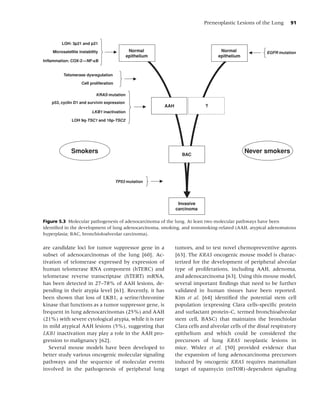 Preneoplastic Lesions of the Lung       91



         LOH: 3p21 and p21

    Microsatellite instability                 Normal                                Normal                EGFR mutation
                                              epithelium                            epithelium



          Telomerase dysregulation

                    Cell proliferation

                            KRAS mutation
   p53, cyclin D1 and survivin expression
                                                           AAH                ?
                          LKB1 inactivation

              LOH 9q-TSC1 and 16p-TSC2




              Smokers                                               BAC
                                                                                                 Never smokers



                                         TP53 mutation




                                                                  Invasive
                                                                 carcinoma

Figure 5.3 Molecular pathogenesis of adenocarcinoma of the lung. At least two molecular pathways have been
identiﬁed in the development of lung adenocarcinoma, smoking, and nonsmoking-related (AAH, atypical adenomatous
hyperplasia; BAC, bronchioloalveolar carcinoma).

are candidate loci for tumor suppressor gene in a                tumors, and to test novel chemopreventive agents
subset of adenocarcinomas of the lung [60]. Ac-                  [63]. The KRAS oncogenic mouse model is charac-
tivation of telomerase expressed by expression of                terized for the development of peripheral alveolar
human telomerase RNA component (hTERC) and                       type of proliferations, including AAH, adenoma,
telomerase reverse transcriptase (hTERT) mRNA,                   and adenocarcinoma [63]. Using this mouse model,
has been detected in 27–78% of AAH lesions, de-                  several important ﬁndings that need to be further
pending in their atypia level [61]. Recently, it has             validated in human tissues have been reported.
been shown that loss of LKB1, a serine/threonine                 Kim et al. [64] identiﬁed the potential stem cell
kinase that functions as a tumor suppressor gene, is             population (expressing Clara cells-speciﬁc protein
frequent in lung adenocarcinomas (25%) and AAH                   and surfactant protein-C, termed bronchioalveolar
(21%) with severe cytological atypia, while it is rare           stem cell, BASC) that maintains the bronchiolar
in mild atypical AAH lesions (5%), suggesting that               Clara cells and alveolar cells of the distal respiratory
LKB1 inactivation may play a role in the AAH pro-                epithelium and which could be considered the
gression to malignancy [62].                                     precursors of lung KRAS neoplastic lesions in
   Several mouse models have been developed to                   mice. Wislez et al. [50] provided evidence that
better study various oncogenic molecular signaling               the expansion of lung adenocarcinoma precursors
pathways and the sequence of molecular events                    induced by oncogenic KRAS requires mammalian
involved in the pathogenesis of peripheral lung                  target of rapamycin (mTOR)-dependent signaling
 