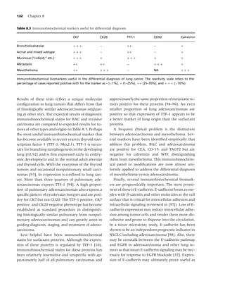 132    Chapter 8


Table 8.3 Immunohistochemical markers useful for differential diagnosis.

                                     CK7               CK20                TTF-1           CDX2              Calretinin

Bronchioloalveolar                   +++               −                   ++              −                 +
Acinar and mixed subtype             +++               −                   ++              −                 +
Mucinous (“colloid,” etc.)           +++               +                   +++             +                 +
Metastatic                           ++                ++                  −               +++               +
Mesothelioma                         ++                +++                 −               NA                +++

Immunohistochemical biomarkers useful in the differential diagnosis of lung cancer. The reactivity scale refers to the
percentage of cases reported positive with for the marker as – (<1%), + (1–25%), ++ (25–70%), and + + + (>70%).




Results of these tests reﬂect a unique molecular              approximately the same proportion of metastatic tu-
conﬁguration in lung tumors that differs from that            mors positive for these proteins [94–96]. An even
of histologically similar adenocarcinomas originat-           smaller proportion of lung adenocarcinomas are
ing at other sites. The expected results of diagnostic        positive so that expression of TTF-1 appears to be
immunohistochemical stains for BAC and invasive               a better marker of lung origin than the surfactant
carcinoma are compared to expected results for tu-            proteins.
mors of other types and origins in Table 8.3. Perhaps            A frequent clinical problem is the distinction
the most useful immunohistochemical marker that               between adenocarcinoma and mesothelioma. Sev-
has become available in recent years is thyroid tran-         eral markers have been identiﬁed empirically that
scription factor 1 (TTF-1, Nkx2.1). TTF-1 is neces-           address this problem. BAC and adenocarcinoma
sary for branching morphogenesis in the developing            are positive for CEA, CD-15, and TAG72 but are
lung [10,92] and is ﬁrst expressed early in embry-            negative for calretinin and WT1 distinguishing
onic development and in the normal adult alveolar             them from mesothelioma. This immunohistochem-
and thyroid cells. With the exception of the thyroid          ical panel or modiﬁcations are now almost uni-
tumors and occasional nonpulmonary small carci-               formly applied to address the differential diagnosis
nomas [93], its expression is conﬁned to lung can-            of mesothelioma versus adenocarcinoma.
cer. More than three quarters of pulmonary ade-                  Finally, several immunohistochemical biomark-
nocarcinomas express TTF-1 [94]. A high propor-               ers are prognostically important. The most promi-
tion of pulmonary adenocarcinomas also express a              nent of these is E-cadherin. E-cadherin forms a com-
speciﬁc pattern of cytokeratin isotypes and are posi-         plex with β-catenin and other molecules at the cell
tive for CK7 but not CD20. The TTF-1 positive, CK7            surface that is critical for intercellular adhesion and
positive, and CK20 negative phenotype has become              intracellular signaling (reviewed in [97]). Loss of E-
established as standard procedure in distinguish-             cadherin expression may reduce intercellular adhe-
ing histologically similar pulmonary from nonpul-             sion among tumor cells and render them more dis-
monary adenocarcinomas and can greatly assist in              cohesive and prone to disperse into the circulation.
guiding diagnosis, staging, and treatment of adeno-           In a tissue microarray study, E-cadherin has been
carcinoma.                                                    shown to be an independent prognostic indicator in
   Less helpful have been immunohistochemical                 NSCLC including adenocarcinoma [98]. Also, there
stains for surfactant proteins. Although the expres-          may be crosstalk between the E-cadherin pathway
sion of these proteins is regulated by TTF-1 [10],            and EGFR in adenocarcinoma and other lung tu-
immunohistochemical stains for these proteins has             mors so that intact E-cadherin signaling may be nec-
been relatively insensitive and unspeciﬁc with ap-            essary for response to EGFR blockade [37]. Expres-
proximately half of all pulmonary carcinomas and              sion of E-cadherin may ultimately prove useful as
 