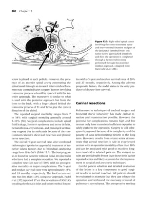 202   Chapter 13




                                                                         Figure 13.5 Right-sided apical tumor
                                                                         involving the costo-transverse space
                                                                         and intervertebral foramen and part of
                                                                         the ipsilateral vertebral body; this
                                                                         tumor is ﬁrst approached anteriorly
                                                                         and then the operation is completed
                                                                         through a hemivertebrectomy
                                                                         performed through the posterior
                                                                         midline approach. (Adapted from
                                                                         Dartevelle et al. [28].)



screw is placed in each pedicle. However, the pres-     ina with a 5-year and median survival rates of 20%
ence of an anterior spinal artery penetrating the       and 27 months, respectively. Among the adverse
spinal canal through an invaded intervertebral fora-    prognostic factors, the nodal status is the only pre-
men may contraindicates surgery. Tumors involving       dictor of disease-free survival.
transverse processes should be resected with the an-
terior approach. The maneuver is similar to what
is used with the posterior approach but from the
front to the back, with a ﬁnger placed behind the       Carinal resections
transverse process of T1 and T2 to give the correct
direction of the chisel.                                Reﬁnement in techniques of tracheal surgery and
   The reported surgical morbidity ranges from 7        bronchial sleeve lobectomy has made carinal re-
to 38% with surgical mortality generally around         section and reconstruction possible. However, the
5–10% [38]. Surgical complications include spinal       potential for complications remains high and few
ﬂuid leakage, Horner’s syndrome and nerve deﬁcits,      centers only have cumulated sufﬁcient expertise to
hematothorax, chylothorax, and prolonged ventila-       safely perform the operation. Surgery is still infre-
tory support due to atelectasis because of the con-     quently proposed because of its complexity and the
comitant extended chest wall resection and phrenic      paucity of data demonstrating beneﬁt in the long
nerve resection.                                        term. However, results from recent series demon-
   The overall 5-year survival rates after combined     strate that carinal resection is safe in experienced
radiosurgical (posterior approach) treatment of su-     centers with an operative mortality of less than 10%
perior sulcus tumors due to bronchial carcinoma         and can be associated with good to excellent long-
range from 18 to 56% (Table 13.3). The best progno-     term survival in selected patients. The current re-
sis is found in patients without nodal involvement      sults are considerably better than those from earlier
who have had a complete resection. We reported a        reported series and likely accounts for the improve-
complete resection rate of 100% with no postoper-       ment in surgical and anesthetic techniques.
ative mortality or major complications. The 5-year         Careful patient selection and detailed evaluation
and median survival rates were approximately 35%        of the lesion is a key component to good surgi-
and 18 months, respectively. The local recurrence       cal results in carinal resection. All patients should
rate was less than 1.8% using our approach. Fadel       be evaluated to ascertain that they can tolerate the
et al. [37] reported 17 en bloc resections of NSCLCs    operation and withstand the necessary removal of
invading the thoracic inlet and intervertebral foram-   pulmonary parenchyma. The preoperative workup
 