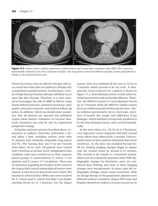 Lung cancer, 3rd ed