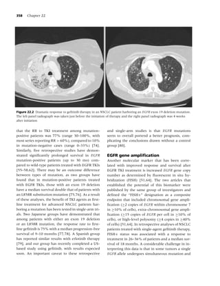 Lung cancer, 3rd ed