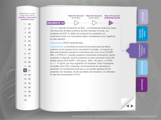 Para obtener más información, visite http://www.abbottdiagnostics.com/Your_Health/Cancer-Oncology/Lung/default.cfm
Resumen
Casos
Prácticos-
Ejemplos
Casos
Practicos/
Interpretación
IntroducciónBibliografía
65
Seleccione un caso y
luego haga click en
HISTORIAL, MARCADOR,
INTERPRETACION.
20
21
22
23
24
25
26
27
28
29
30
31
32
33
34
35
36
37
1
2
3
4
5
6
7
8
9
10
11
12
13
14
15
16
17
18
19
Haga click aquí para
HISTORIAL
Haga click aquí para
MARCADOR
Haga click aquí para
INTERPRETACION
PACIENTE 12
Informe: Discreto incremento de SCC. La insuficiencia renal es la causa
mas frecuente de falsos positivos de éste marcador tumoral. Los
resultados de SCC no deben ser evaluados en pacientes con
insuficiencia renal. Los marcadores deben considerarse como negativos
en este paciente.
Diagnóstico: EPOC sobreinfectada
Comentarios: La insuficiencia renal es la principal causa de falsos
positivos con la mayoría de los marcadores tumorales. La mayoría de
ellos solo presentan pequeños incrementos pero otros como ProGRP,
NSE y CYFRA 21-1 pueden presentar importantes incrementos, siendo
necesario un segundo nivel de sospecha en estos pacientes (19,20,26).
Niveles séricos de ProGRP  350 pg/mL, NSE  60 ng/mL o CYFRA
21-1  14 ng/mL son muy sugestivos de neoplasia. Otros marcadores
tumorales como SCC, presentan concentraciones tan elevadas en
pacientes con insuficiencia renal que no se pueden distinguir de los
pacientes con neoplasia, de ahí que deban ser excluidos y no valorados
en este tipo de pacientes (19-21).
12
 