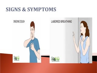 Lung cancer ll | PPT