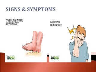 Lung cancer ll | PPT
