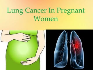 Lung Cancer In Pregnant
Women
 