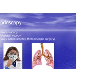 Endoscopy
Bronchoscopy
Mediastinoscopy
VATS (video assisted thoracoscopic surgery)
 