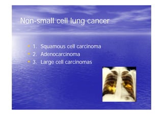 Non-small cell lung cancer
• 1. Squamous cell carcinoma
• 2. Adenocarcinoma
• 3. Large cell carcinomas
 