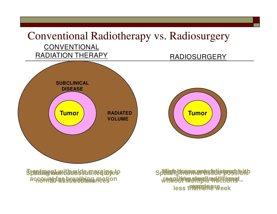 Lung Cancer Radiosurgery