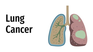 Lung
Cancer
 